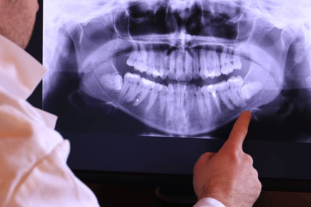 Best Pediatric Emergency Dentist in Fairfield Beach, OH