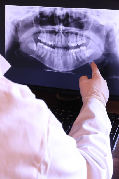 Best Emergency Denture Repair in Fairfield Beach, OH