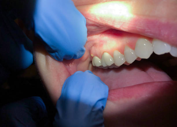 Best Emergency TMJ Treatment in Fairfield Beach, OH