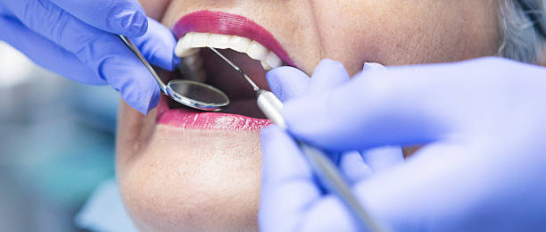 Best Emergency Dental Care for Broken or Chipped Teeth in Fairfield Beach, OH